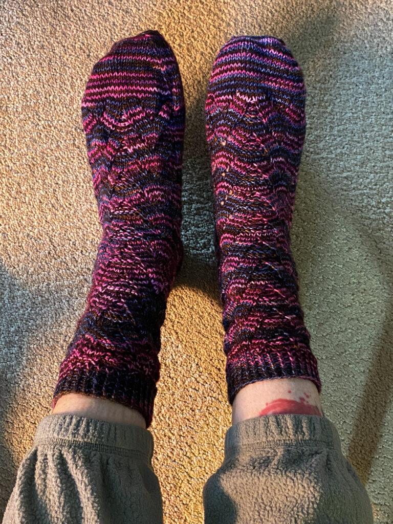 Elder sock on the left, newer on the right